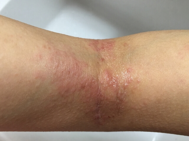 ゴミ屋敷を放置するとこうなる