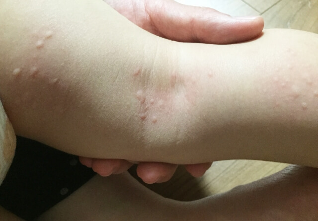 ゴミ屋敷家族は悲惨